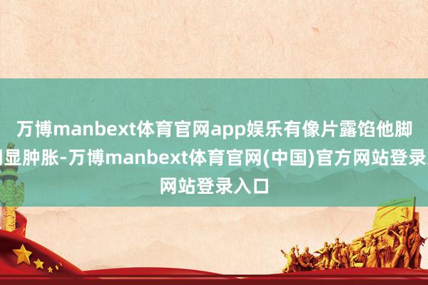 万博manbext体育官网app娱乐有像片露馅他脚踝明显肿胀-万博manbext体育官网(中国)官方网站登录入口